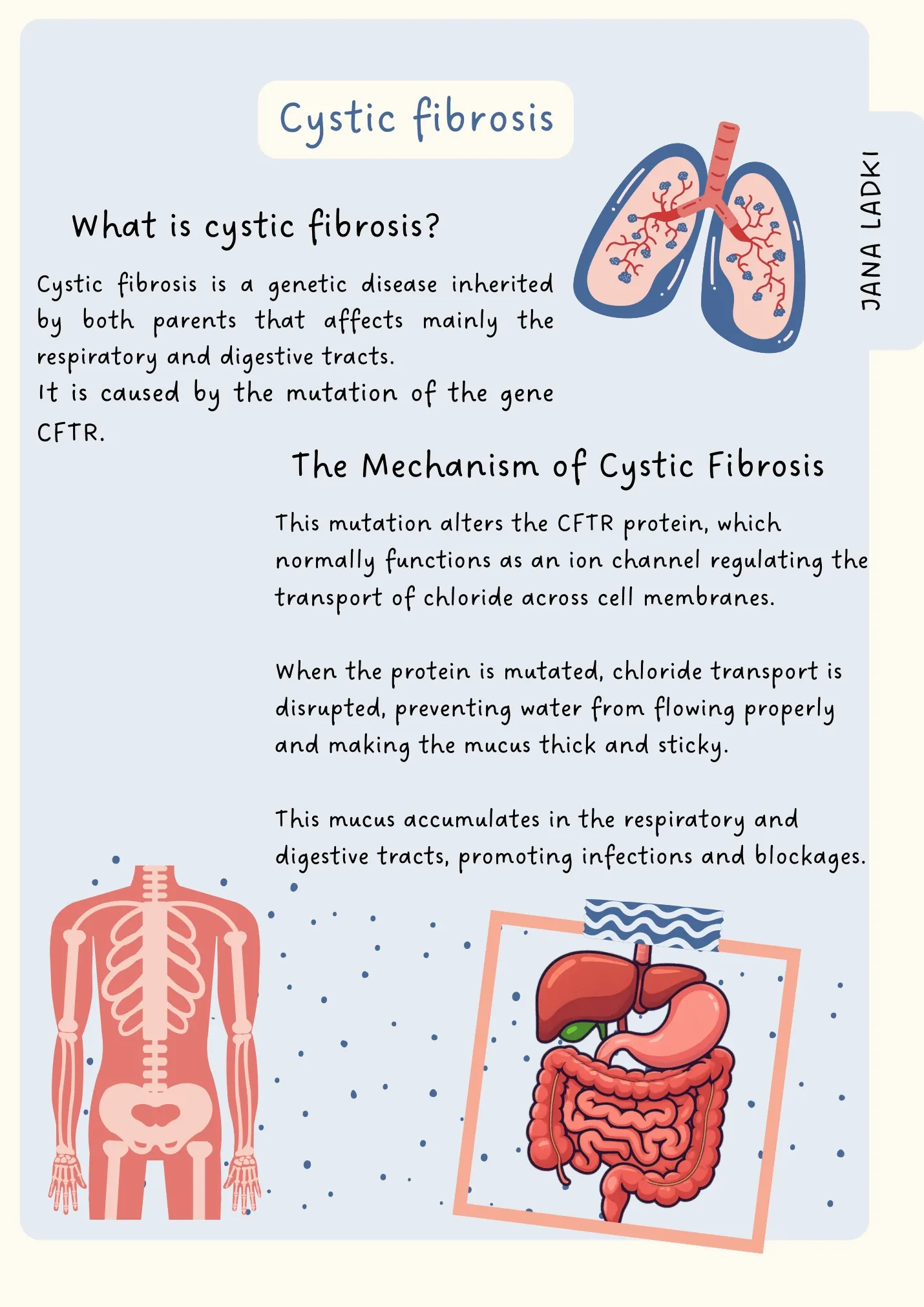 Cystic fibrosis: what it is and the CFTR mechanism, with illustrations of the lungs, skeleton and digestive tract.