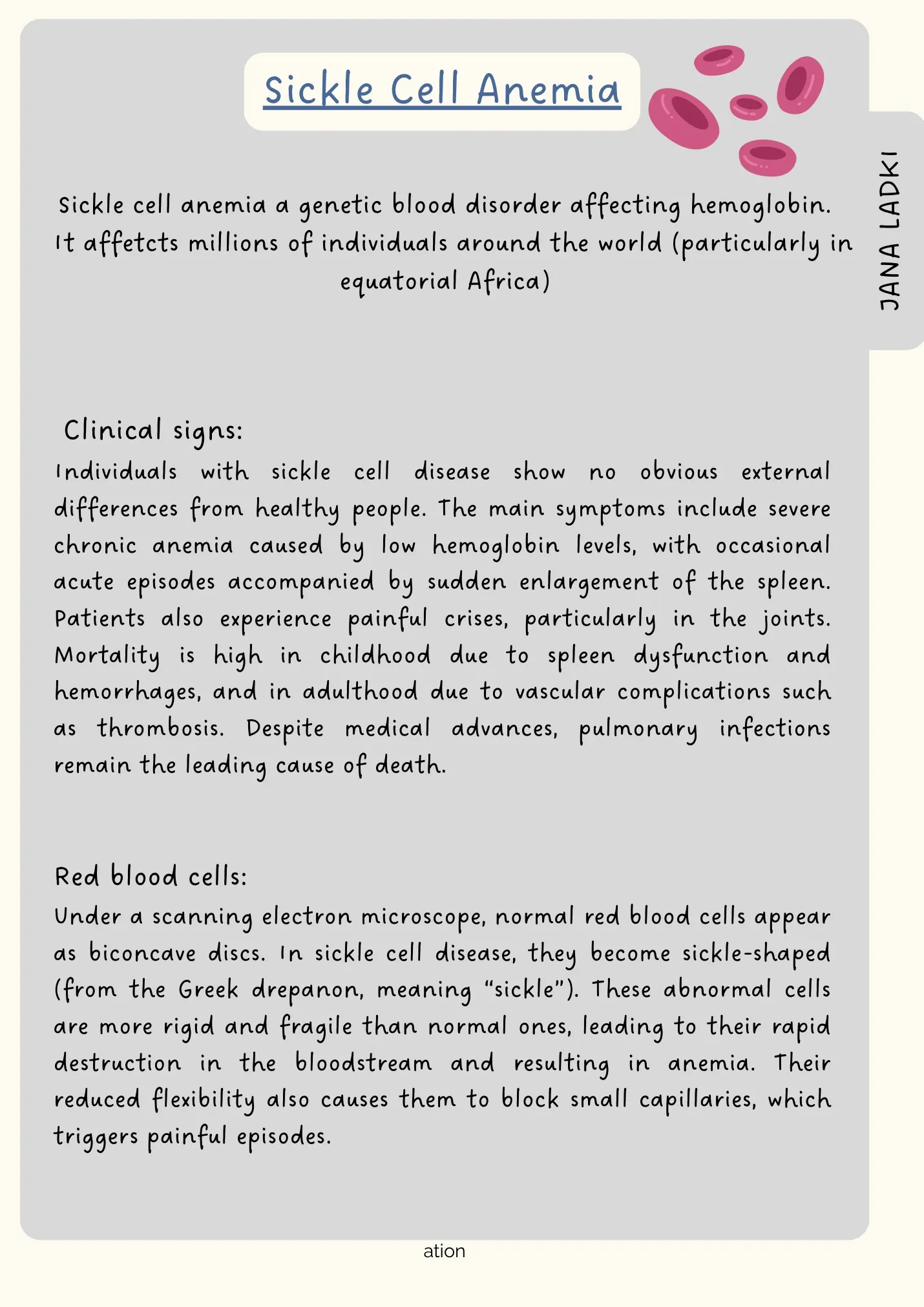Sickle cell anemia: clinical signs and how red blood cells change from biconcave discs to a sickle shape.